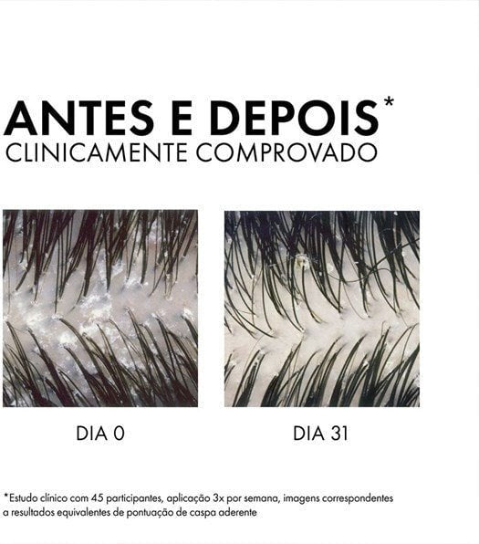 Shampoo Anticaspa Intensivo DS Cabelos Secos 125G